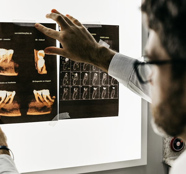 knightstreetdentists.com.au | Dentist reviewing dental X-rays on a light board.